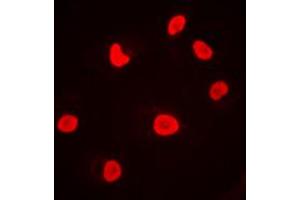 Immunofluorescent analysis of DNA-PKcs staining in MCF7 cells.