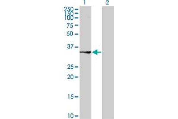 SUCLG1 Antikörper  (AA 125-234)