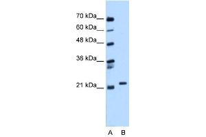 Image no. 1 for anti-RAB11B, Member RAS Oncogene Family (RAB11B) (C-Term) antibody (ABIN2783299)