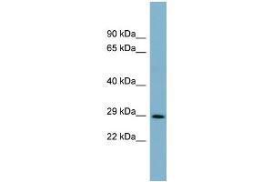 Image no. 2 for anti-Defective in Cullin Neddylation 1, Domain Containing 1 (DCUN1D1) (Middle Region) antibody (ABIN2775481)