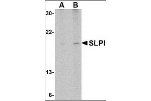 Western blot analysis of SLPI in Daudi cell lysate with this product at (A) 1 and (B) 2 μg/ml.