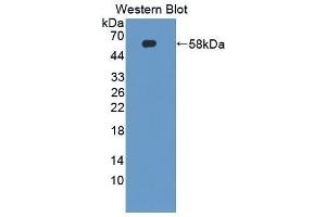 Western Blotting (WB) image for anti-Cyclin-Dependent Kinase Inhibitor 3 (CDKN3) (AA 1-212) antibody (ABIN1867169)