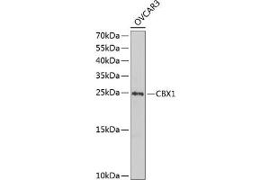 Western blot analysis of extracts of OVCAR-3 cells, using CBX1 antibody (ABIN1512680, ABIN3023224, ABIN3023225 and ABIN6219469) at 1:1000 dilution.