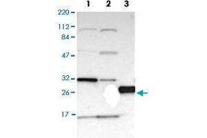 Image no. 2 for anti-PRELI Domain Containing 1 (PRELID1) antibody (ABIN5650159)