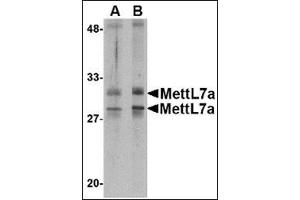 Image no. 2 for anti-Methyltransferase Like 7A (METTL7A) (Center) antibody (ABIN500274)