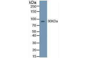 Image no. 6 for Matrix Metallopeptidase 9 (Gelatinase B, 92kDa Gelatinase, 92kDa Type IV Collagenase) (MMP9) ELISA Kit (ABIN6574164)