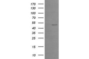Image no. 2 for anti-Early Growth Response 2 (EGR2) (AA 156-476) antibody (ABIN1490983)