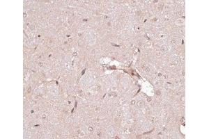Immunohistochemistry of paraffin-embedded Rat brain using CREB1 Polyclonal Antibody at dilution of 1:100 (40x lens).