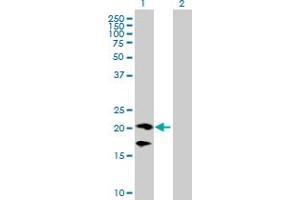 Image no. 2 for anti-CD160 (CD160) (AA 1-181) antibody (ABIN524536)