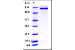 Image no. 1 for serine/arginine-Rich Protein Specific Kinase 3 (SRPK3) (AA 1-566) protein (GST tag,His tag) (ABIN2005059)