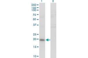 Image no. 4 for anti-Interleukin 20 (IL20) (AA 67-176) antibody (ABIN565488)