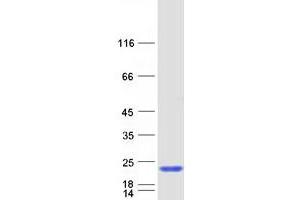 Image no. 1 for Sin3A-Associated Protein, 18kDa (SAP18) protein (Myc-DYKDDDDK Tag) (ABIN2731387)