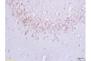 Image no. 1 for anti-Plexin B1 (PLXNB1) (AA 151-250) antibody (ABIN749228)