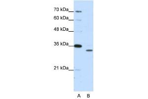 Image no. 1 for anti-Proteasome Subunit alpha Type 1 (PSMA1) antibody (ABIN629944)