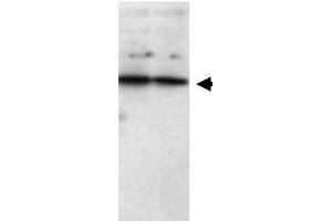 Western blot using  Affinity Purified anti-SFRP1 antibody shows detection of a band ~37 kDa (arrowhead) corresponding to SFRP1 in lysates from human cultured airway epithelial cells.