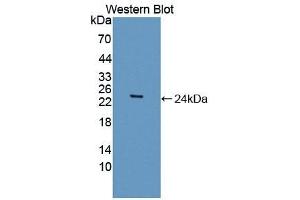 CSRP1 anticorps  (AA 1-193)
