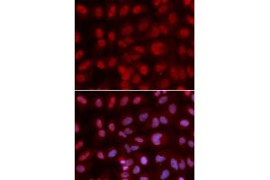 Image no. 2 for anti-SIN3 homolog A, transcription regulator (SIN3A) antibody (ABIN3023703)