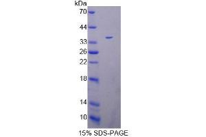 Image no. 1 for Peptidyl Arginine Deiminase, Type IV (PADI4) (AA 1-300) protein (His tag) (ABIN6240005)