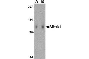 Image no. 1 for anti-SLIT and NTRK-Like Family, Member 1 (SLITRK1) (Middle Region) antibody (ABIN1031098)