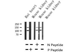 Image no. 2 for anti-Insulin-Like Growth Factor 1 Receptor (IGF1R) (pTyr1161) antibody (ABIN6256620)