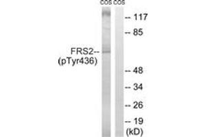Image no. 1 for anti-Fibroblast Growth Factor Receptor Substrate 2 (FRS2) (AA 402-451), (pTyr436) antibody (ABIN1532103)