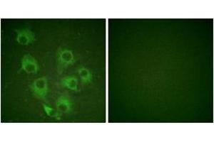 Immunofluorescence analysis of HuvEc cells, using CrkL (Phospho-Tyr207) Antibody.
