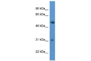 Image no. 1 for anti-Rhophilin Associated Tail Protein 1-Like (ROPN1L) (C-Term) antibody (ABIN2788497)