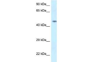 Image no. 1 for anti-Sparc/osteonectin, Cwcv and Kazal-Like Domains Proteoglycan (Testican) 2 (SPOCK2) (N-Term) antibody (ABIN2789077)
