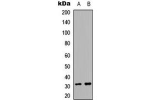 Image no. 1 for anti-Alkaline Ceramidase 2 (ACER2) (Center) antibody (ABIN2705386)