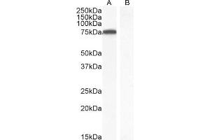 Image no. 4 for anti-IL2-Inducible T-Cell Kinase (ITK) (C-Term) antibody (ABIN184605)