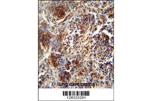Image no. 2 for anti-Zinc Finger Protein 30 (ZFP30) (AA 1-30), (N-Term) antibody (ABIN654563)