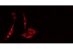 Image no. 2 for anti-Cell Division Cycle Associated 3 (CDCA3) (C-Term) antibody (ABIN6257051)