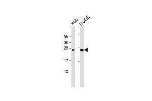 All lanes : Anti-DCTN6 Antibody (Center) at 1:1000 dilution Lane 1: Hela whole cell lysate Lane 2: U-2OS whole cell lysate Lysates/proteins at 20 μg per lane.