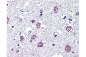 Image no. 1 for anti-Niemann-Pick Disease, Type C1 (NPC1) antibody (ABIN462125)