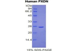 Image no. 1 for Peroxidasin Homolog (PXDN) (AA 76-260) protein (His tag) (ABIN1877678)