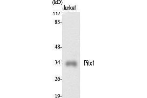 Image no. 2 for anti-Paired-Like Homeodomain 1 (PITX1) (Internal Region) antibody (ABIN3186457)