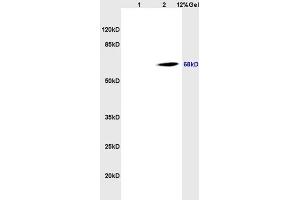 Image no. 1 for anti-Solute Carrier Family 3 (Activators of Dibasic and Neutral Amino Acid Transport), Member 2 (SLC3A2) (AA 231-280) antibody (ABIN719546)