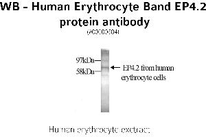 Image no. 1 for anti-erythrocyte Membrane Protein Band 4.2 (EPB42) antibody (ABIN346969)