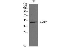 Image no. 3 for anti-Natural Killer Cell Receptor 2B4 (CD244) (Internal Region) antibody (ABIN3188025)