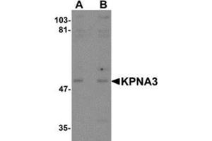 Image no. 1 for anti-Karyopherin alpha 3 (Importin alpha 4) (KPNA3) (C-Term) antibody (ABIN783735)