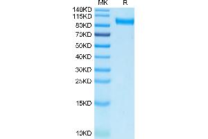 SDS-PAGE (SDS) image for AXL Receptor tyrosine Kinase (AXL) protein (Fc Tag,Biotin) (ABIN7273883)