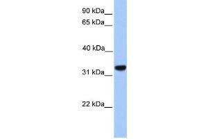 Image no. 1 for anti-Calcium Channel, Voltage-Dependent, gamma Subunit 4 (CACNG4) antibody (ABIN2458134)