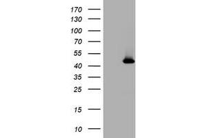 Image no. 1 for anti-Melanoma Antigen Family A, 4 (MAGEA4) antibody (ABIN1499261)