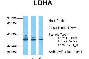 Image no. 1 for anti-Lactate Dehydrogenase A (LDHA) (Middle Region) antibody (ABIN2785876)