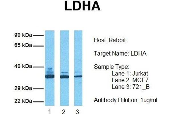 anti-Lactate Dehydrogenase A (LDHA) (Middle Region) antibody