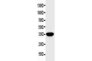 Image no. 1 for anti-Secreted Protein, Acidic, Cysteine-Rich (Osteonectin) (SPARC) (AA 284-303), (C-Term) antibody (ABIN3044449)