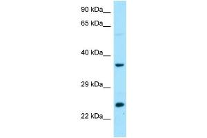 Image no. 1 for anti-D-Tyrosyl-tRNA Deacylase 1 Homolog (S. Cerevisiae) (DTD1) (C-Term) antibody (ABIN2790289)