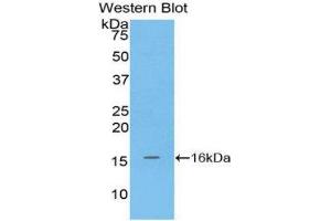 Image no. 1 for anti-Matrix Gla Protein (MGP) (AA 1-103) antibody (ABIN1859812)