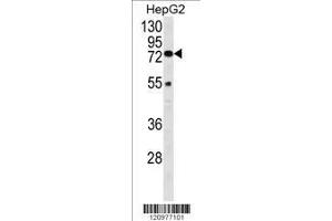 Image no. 1 for anti-Hexosaminidase A (HEXA) (AA 142-170), (N-Term) antibody (ABIN390929)