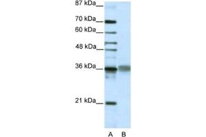 Image no. 1 for anti-T-Cell Leukemia Homeobox 2 (TLX2) antibody (ABIN2461873)